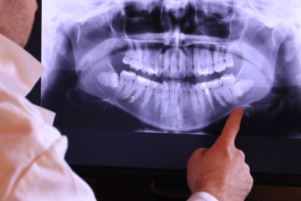 Best Knocked-Out Tooth Emergency  in Graysville, AL